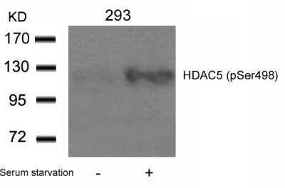 Western Blot: HDAC5 [p Ser498] Antibody [NB100-81953]